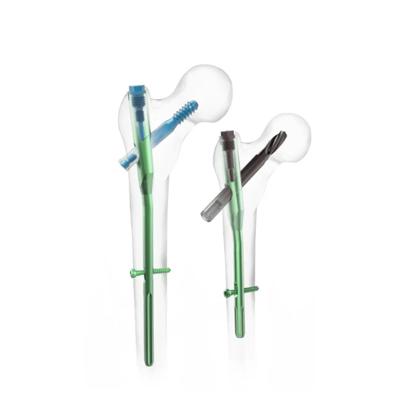 Haste intramedular PFNA | Implante femoral proximal de titânio
