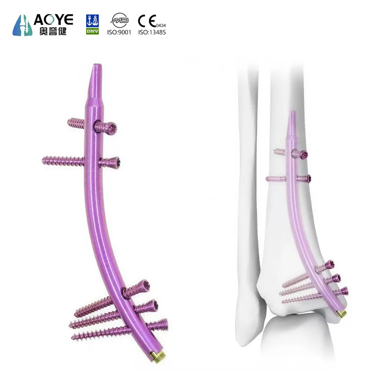 Haste Intramedular Tibial Distal (DTN)